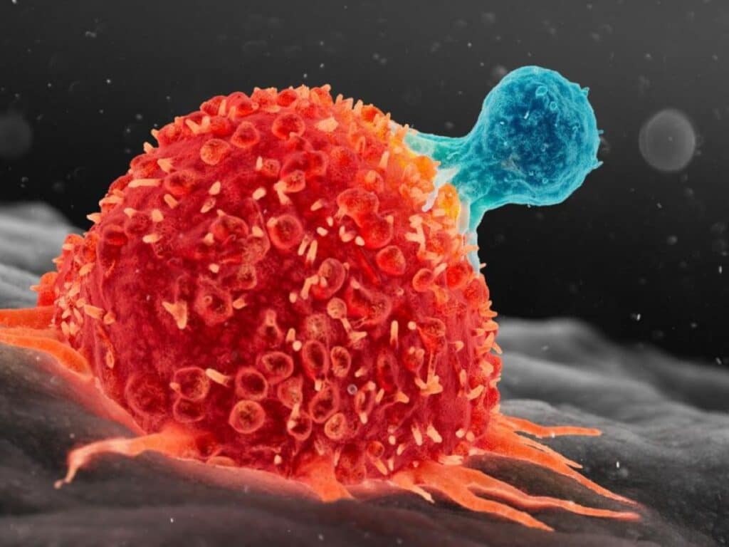 Cancer