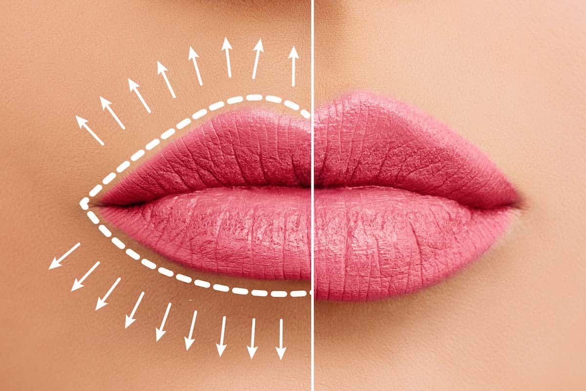 Beauté: ce demarmatologue révèle comment avoir des lèvres sublimes très simplement!