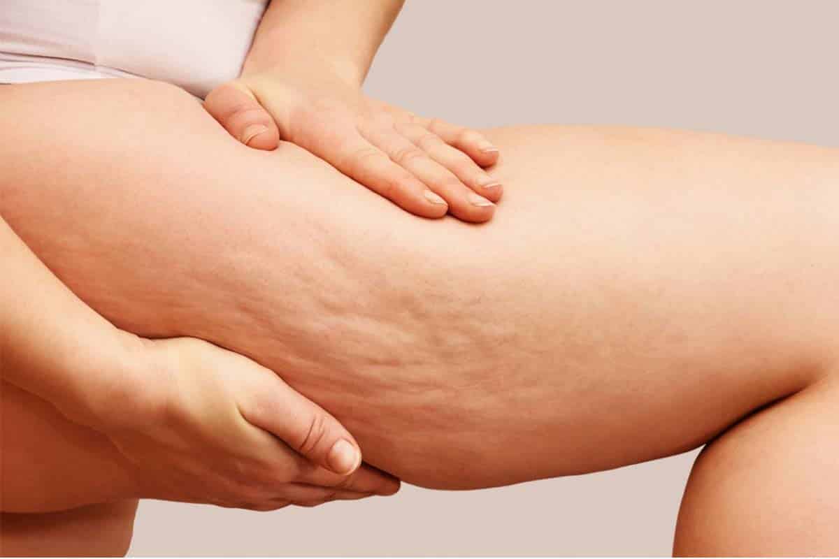Beauté : pour dire adieu à la cellulite et avoir une peau lisse, voici la recette naturelle d’une naturopathe